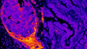 The Nuclear Metabolic Fingerprint: Over 200 Enzymes Found Directly on Human DNA Rewrite Cellular Understanding