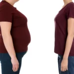 Lifestyle Changes Fall Short for Some at High Risk of Type 2 Diabetes