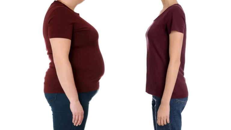 Lifestyle Changes Fall Short for Some at High Risk of Type 2 Diabetes