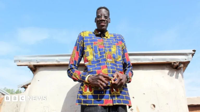 Tragic Passing of Gambaga’s Gentle Giant: Awuche, Known for Marfan Syndrome and Community Identity, Dies Unexpectedly